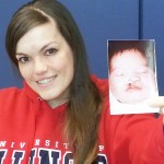Gina Davis holds a photo of her as a baby with a cleft lip and palate.