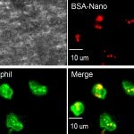 green-labeled neutrophils with red-labeled nanoparticles inside, which appear yellow.