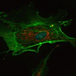 endothelial cell