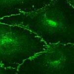 Adherens Junctions