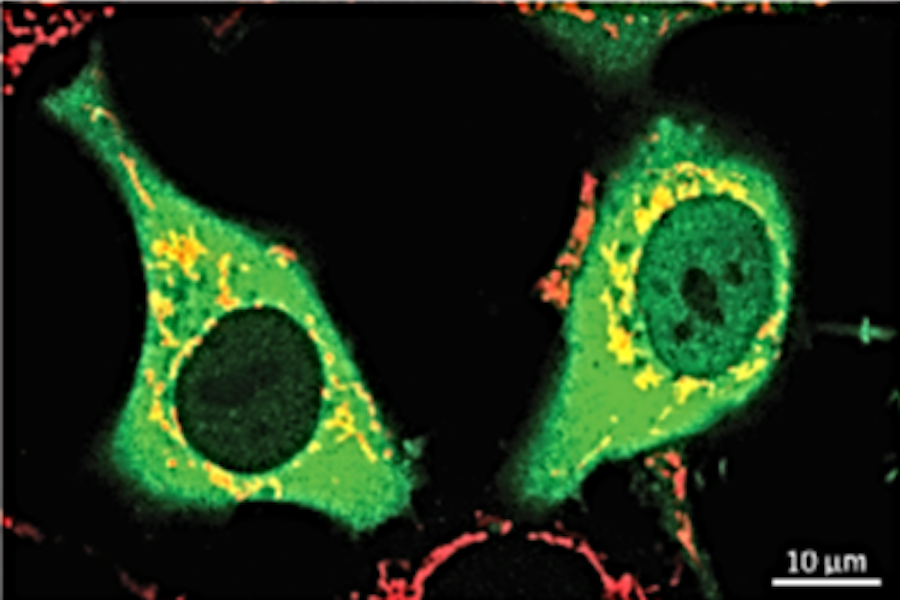 Green cells with yellow spots.